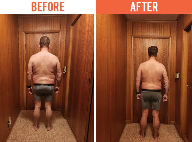Eastside Weight Loss - Before & After